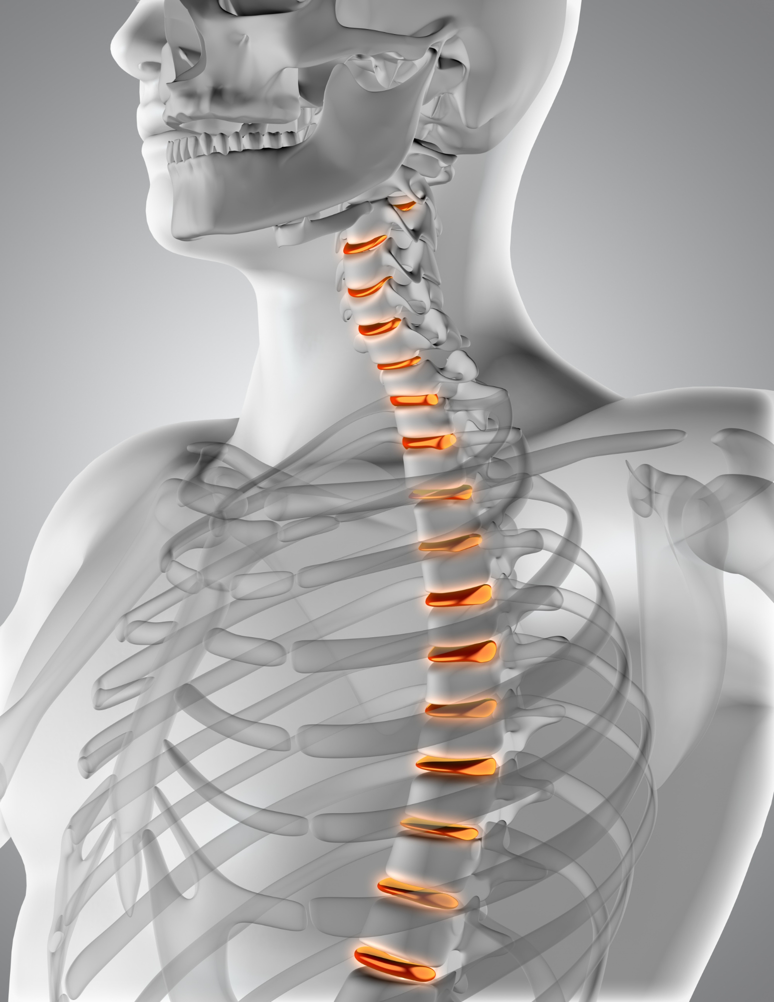 chiropractor for herniated disc